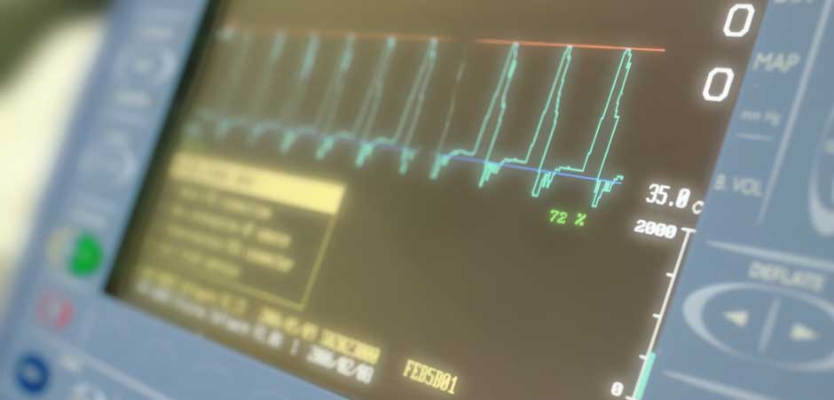 Radiofrequency Lesioning