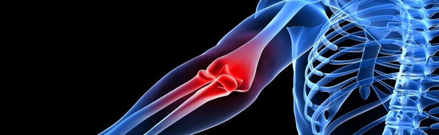 Elbow Pain